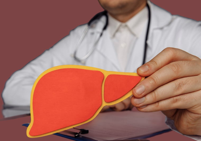 Жировой гепатоз: причины появления, симптомы, коррекция